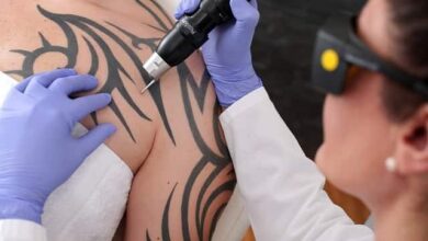Laserbehandlung - was ist das eigentlich? 1