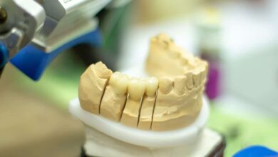Zahnersatz: Zahnkronen, Brücken und Implantate 2