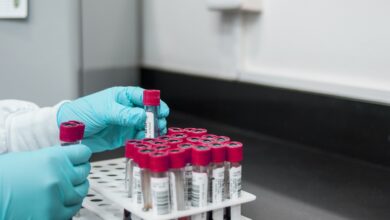 Etikettierung in der Chemie 8 Etikettierung in der Chemie 8