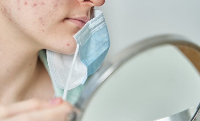 Periorale Dermatitis durch Maskenpflicht 1